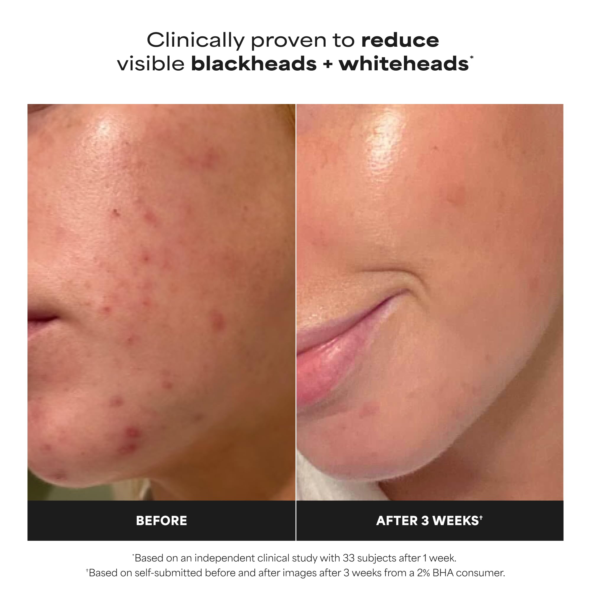 Paula's Choice liquid texture on skin demonstrating lightweight, non-greasy feel