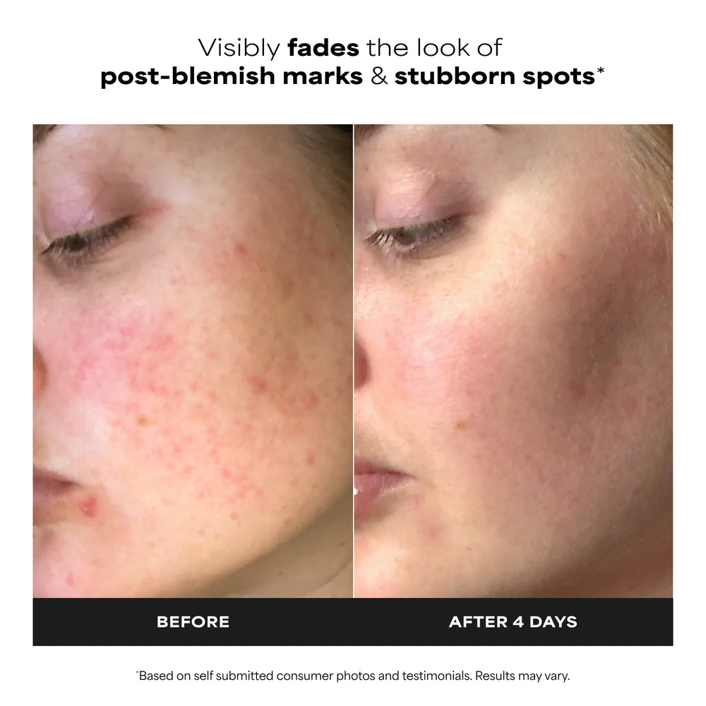 Paula's Choice cream-gel texture close-up showing fast absorption