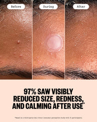 PEACE OUT dot applied on skin illustrating discreet coverage and protection