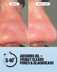 PEACE OUT disposable extractor tool detail for safer blackhead removal