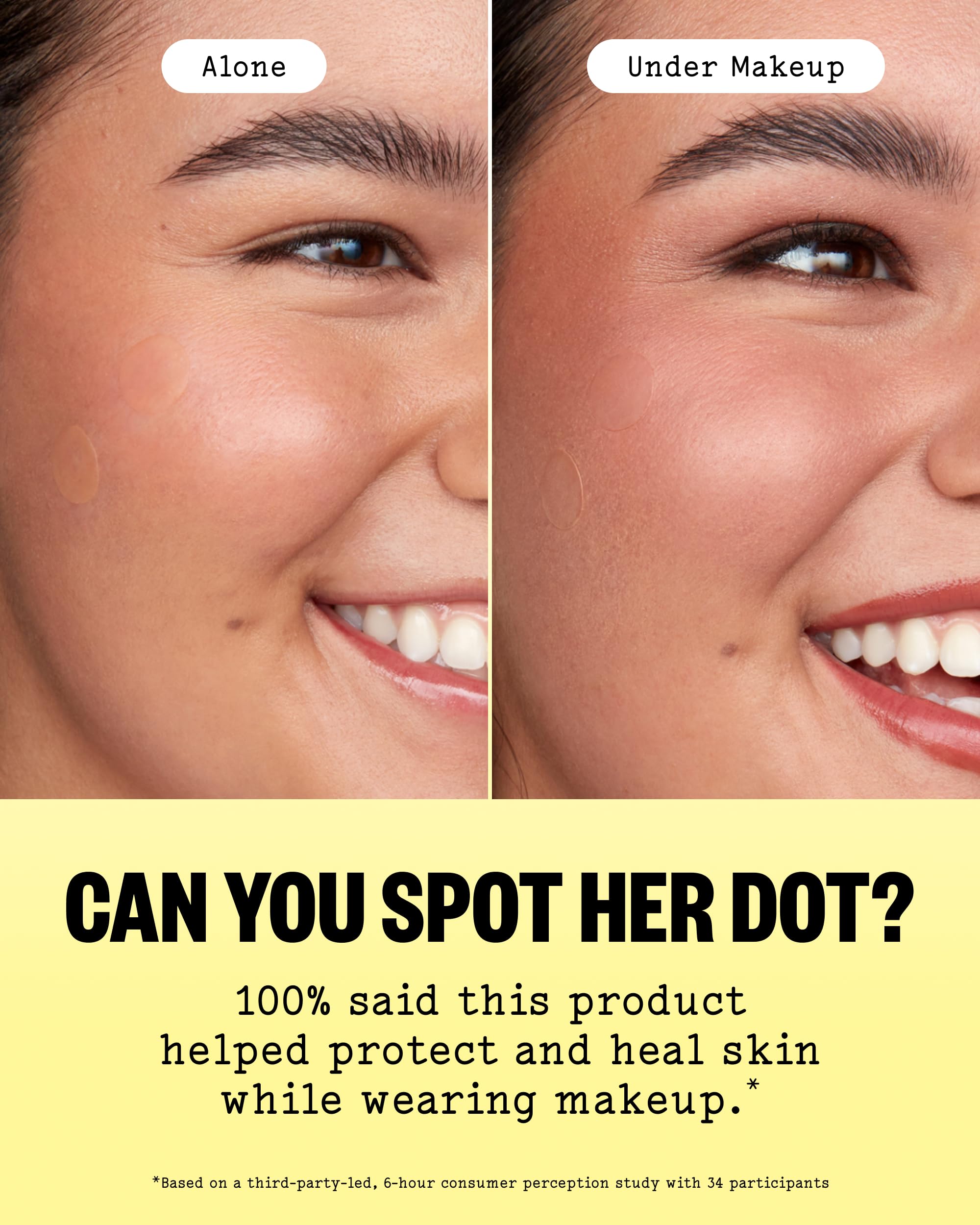 PEACE OUT healing dot applied on cheek overnight, promotes calmer-looking skin