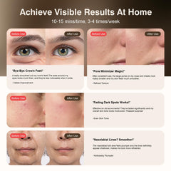 pedete mask side profile showing 3D silicone contour for snug fit
