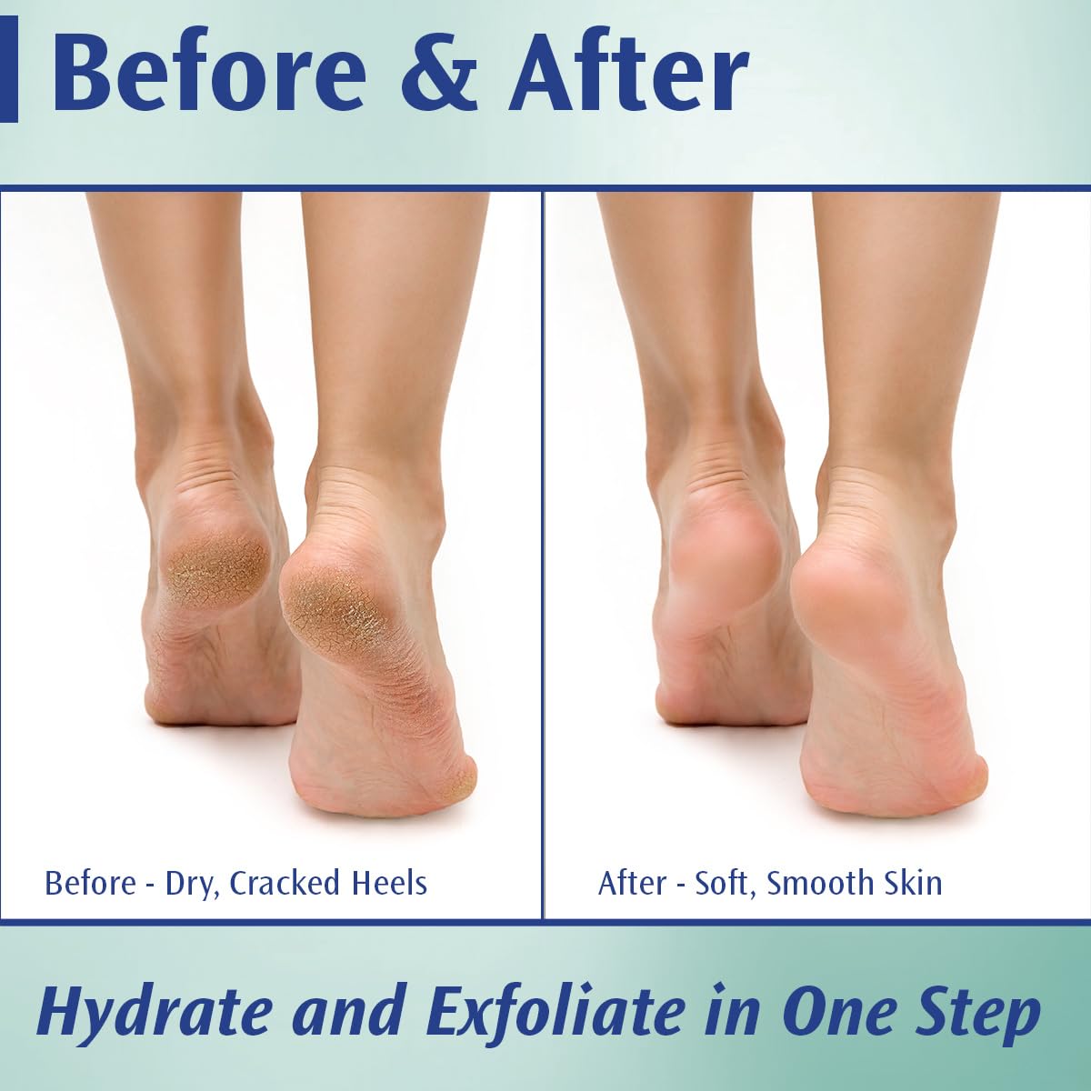 Pedifix cream texture close-up demonstrating rich consistency and fast absorption
