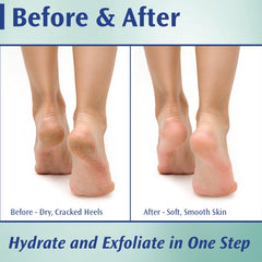 Pedifix cream texture close-up demonstrating rich consistency and fast absorption