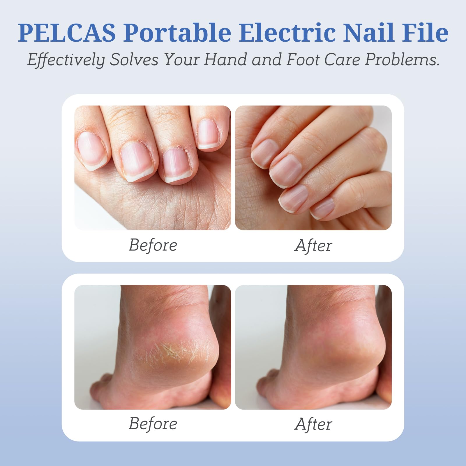 PELCAS arranged attachment set with bits and sanding bands showing kit versatility