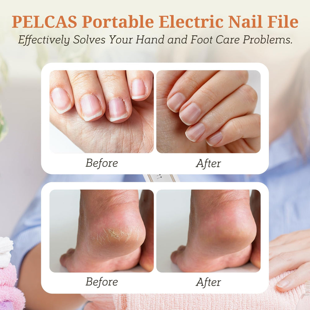 PELCAS arrangement of 8 drill bits showing variety for shaping, grinding, polishing benefits