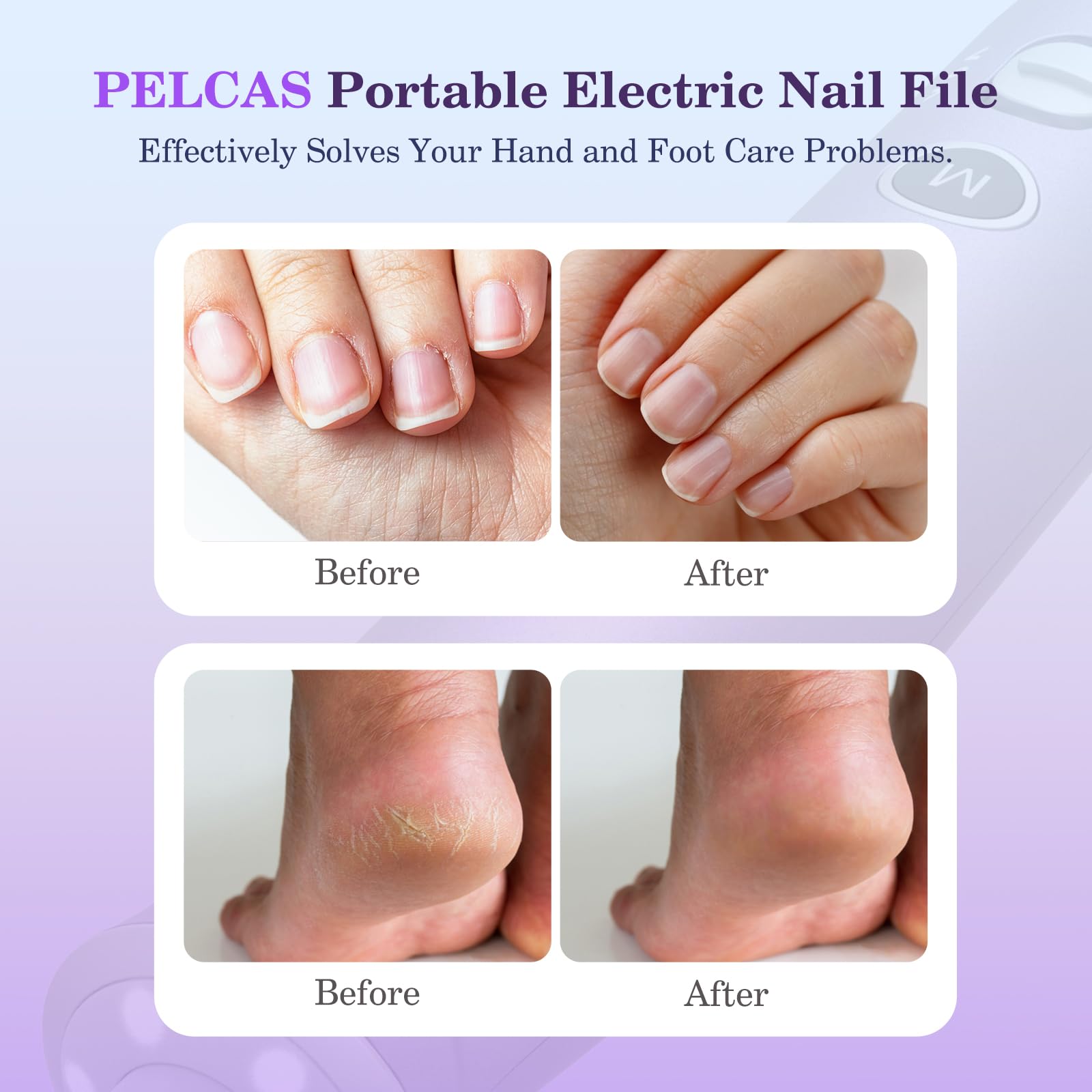 PELCAS ergonomic pen grip close-up reduces hand fatigue