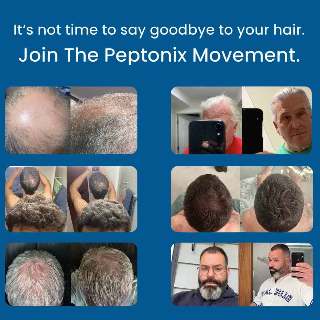 Peptonix serum being applied to scalp, promoting nourishment and comfort