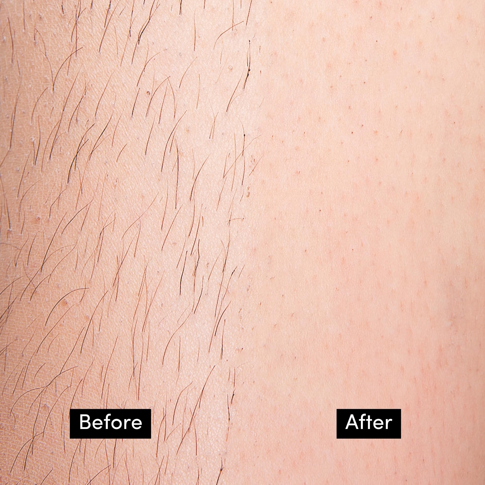 Close facial application of Persian cold wax showing gentle removal on sensitive skin