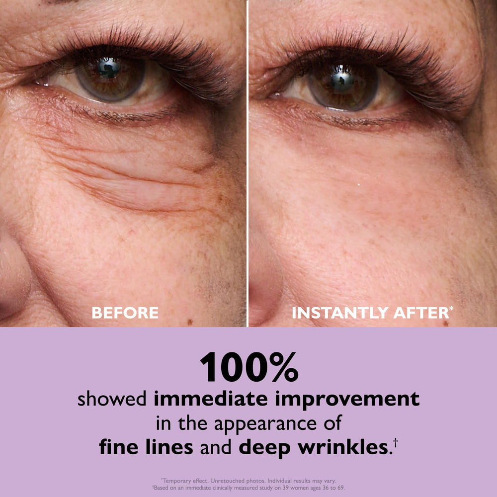 Peter Thomas Roth before and after composite displaying visible tightening