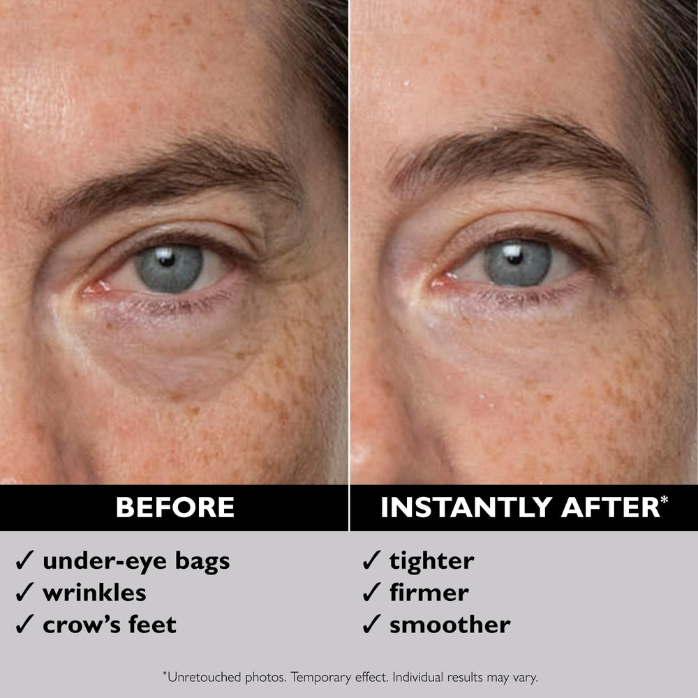 Peter Thomas Roth before and after showing reduced under-eye puffiness