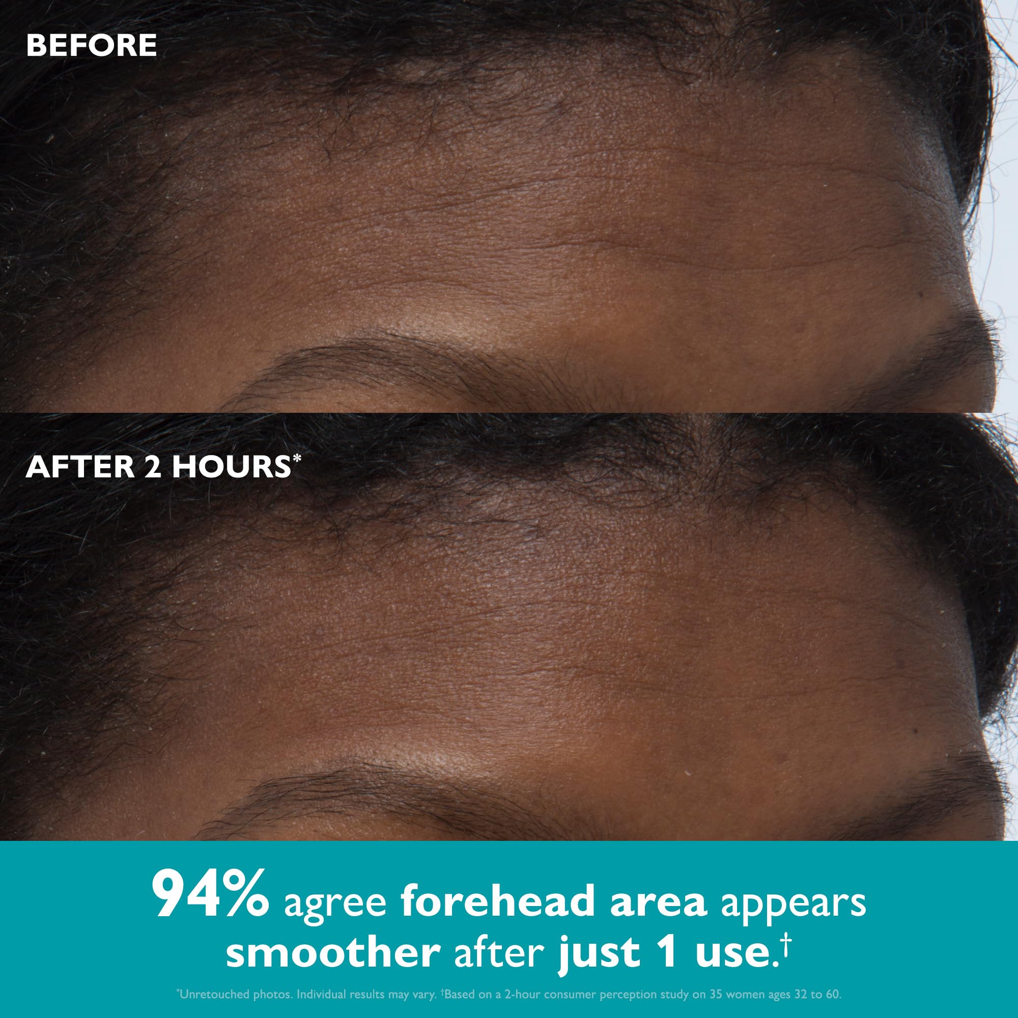 Peter Thomas Roth tape placed under-eye reducing the look of creases