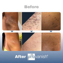 PFB Vanish texture on skin detail highlights lightweight absorption benefit