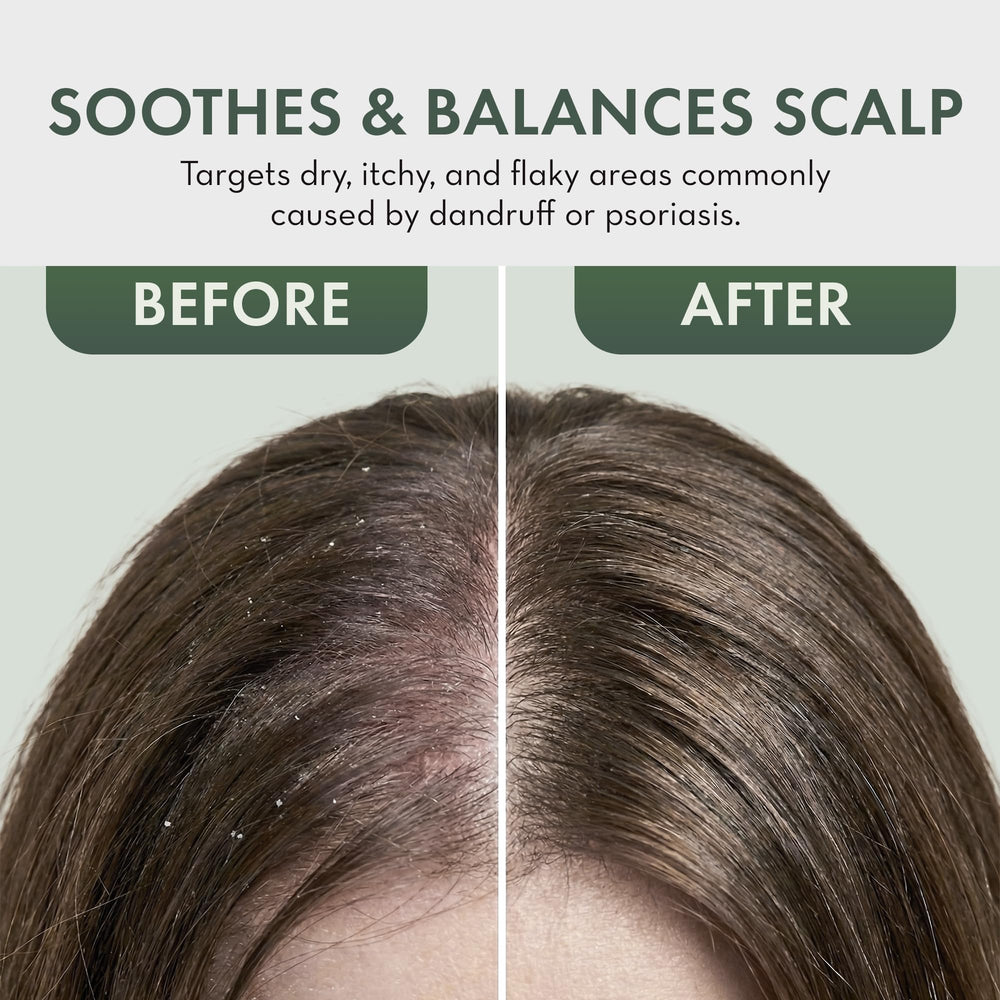 PHARM TO TABLE spray applied under braids, reaches scalp without disrupting style