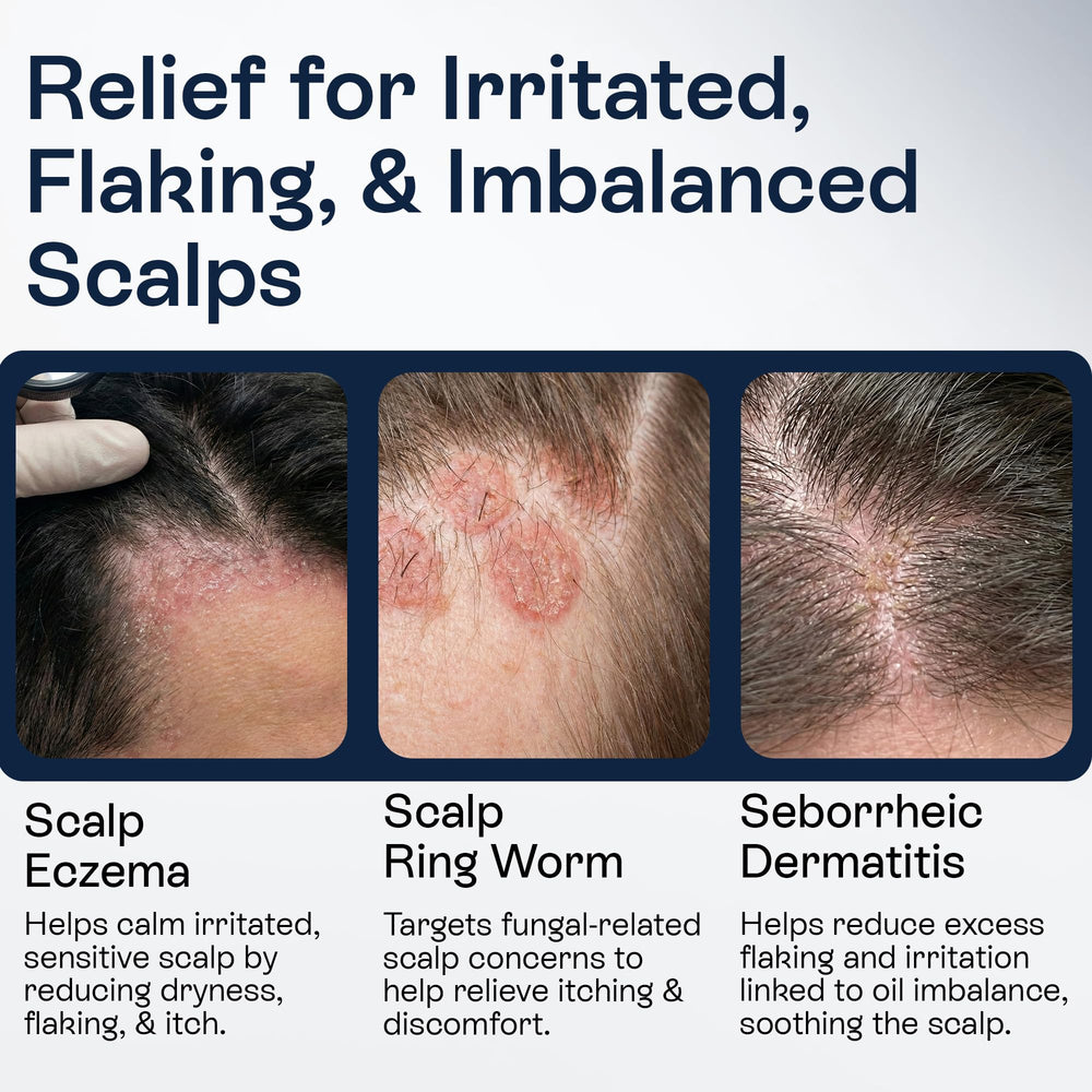 Pharmlitalia being applied to scalp for focused flake relief