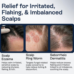 Pharmlitalia being applied to scalp for focused flake relief