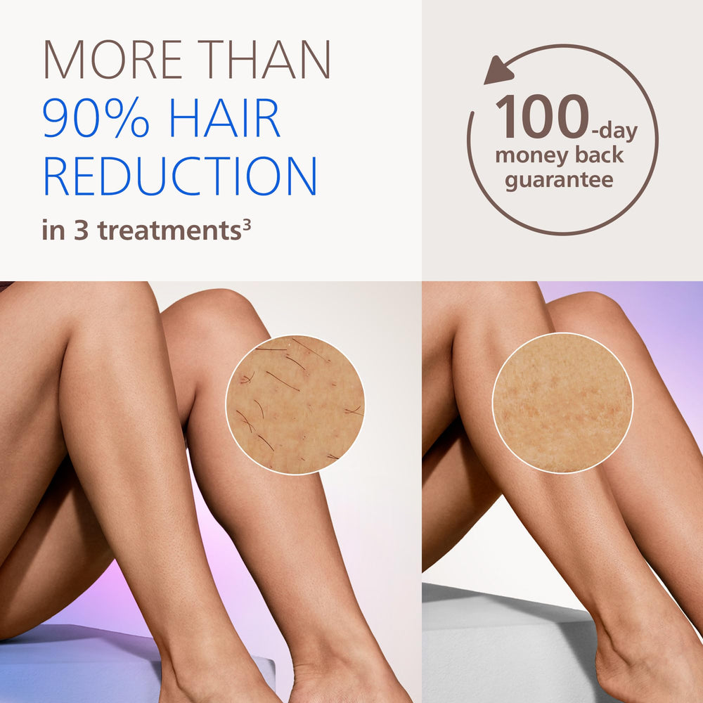 Philips Lumea in hand treating arm demonstrating guided motion for full coverage