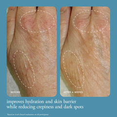 philosophy applying cream to hand demonstrating smoothing and barrier support