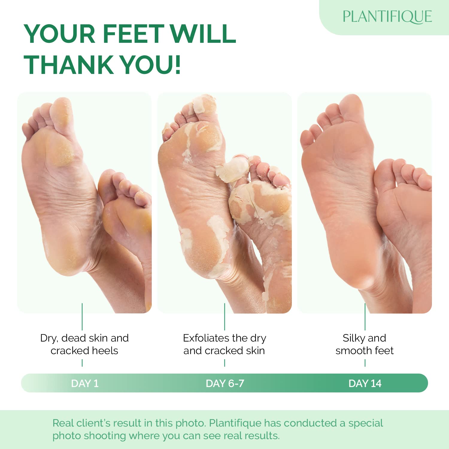 PLANTIFIQUE close-up of bootie mask material for comfortable fit