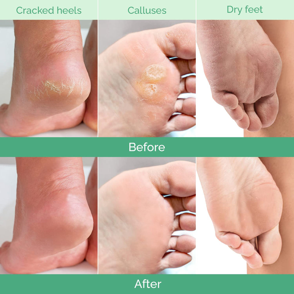 PLANTIFIQUE applying peach-scented formula with visible ease