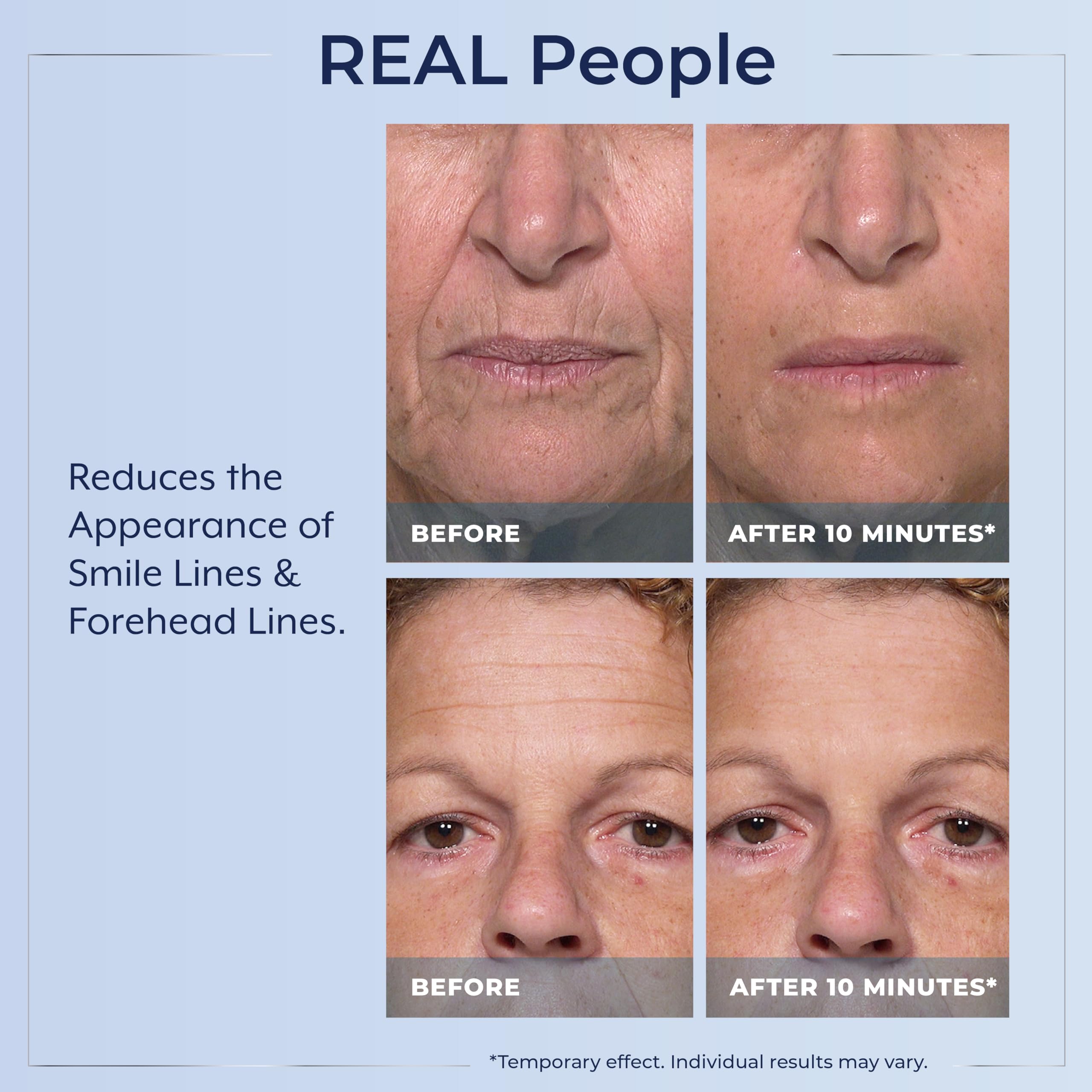Plexaderm being applied under eye demonstrating quick visible tightening