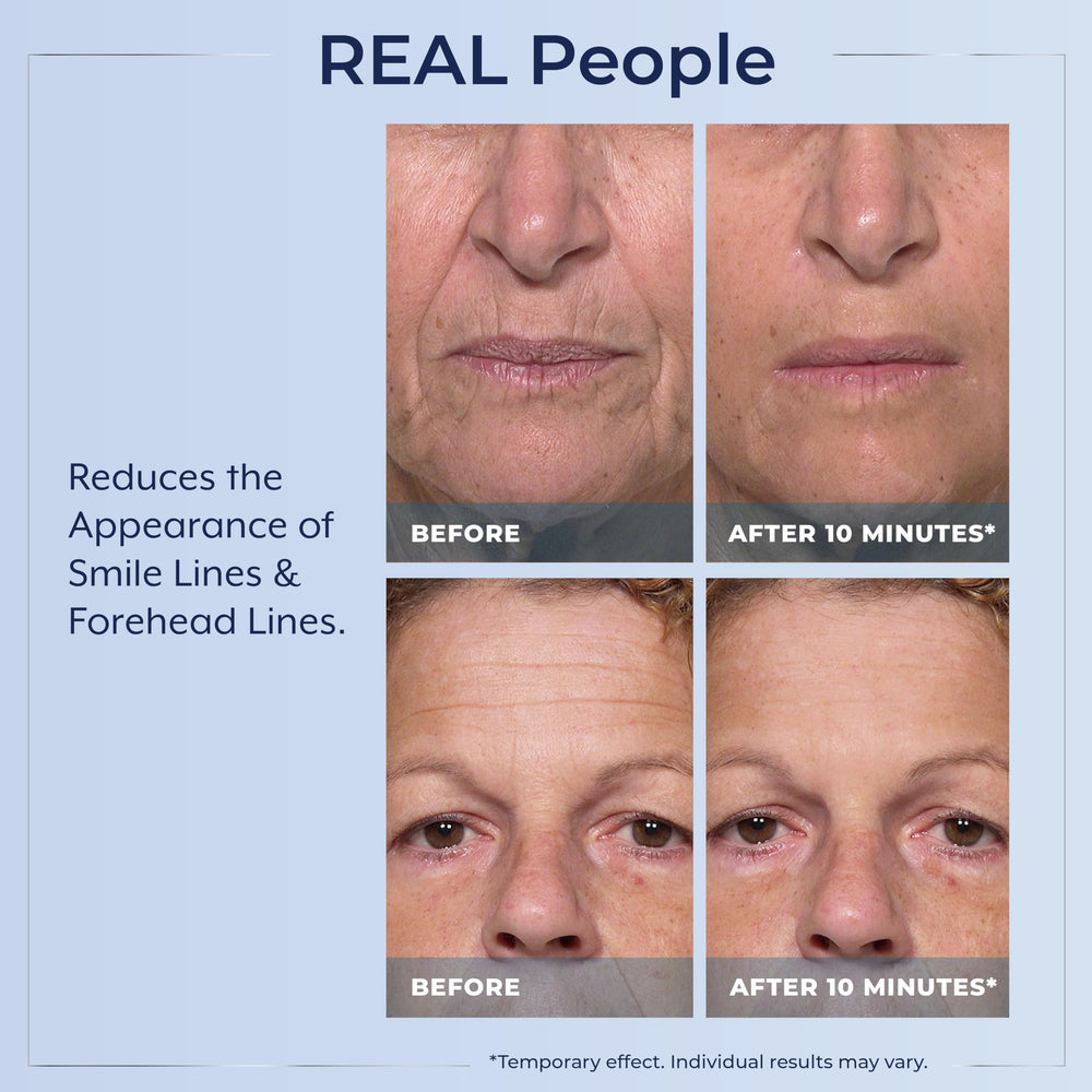 Plexaderm being applied under eye demonstrating quick visible tightening