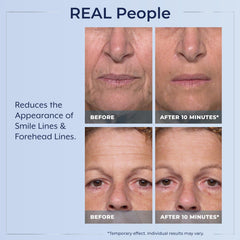 Plexaderm being applied under eye demonstrating quick visible tightening