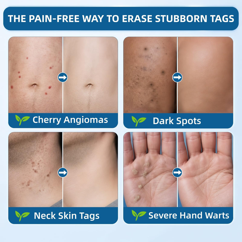 POYICGS being applied on skin demonstrating easy targeted coverage