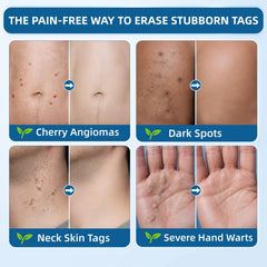 POYICGS being applied on skin demonstrating easy targeted coverage
