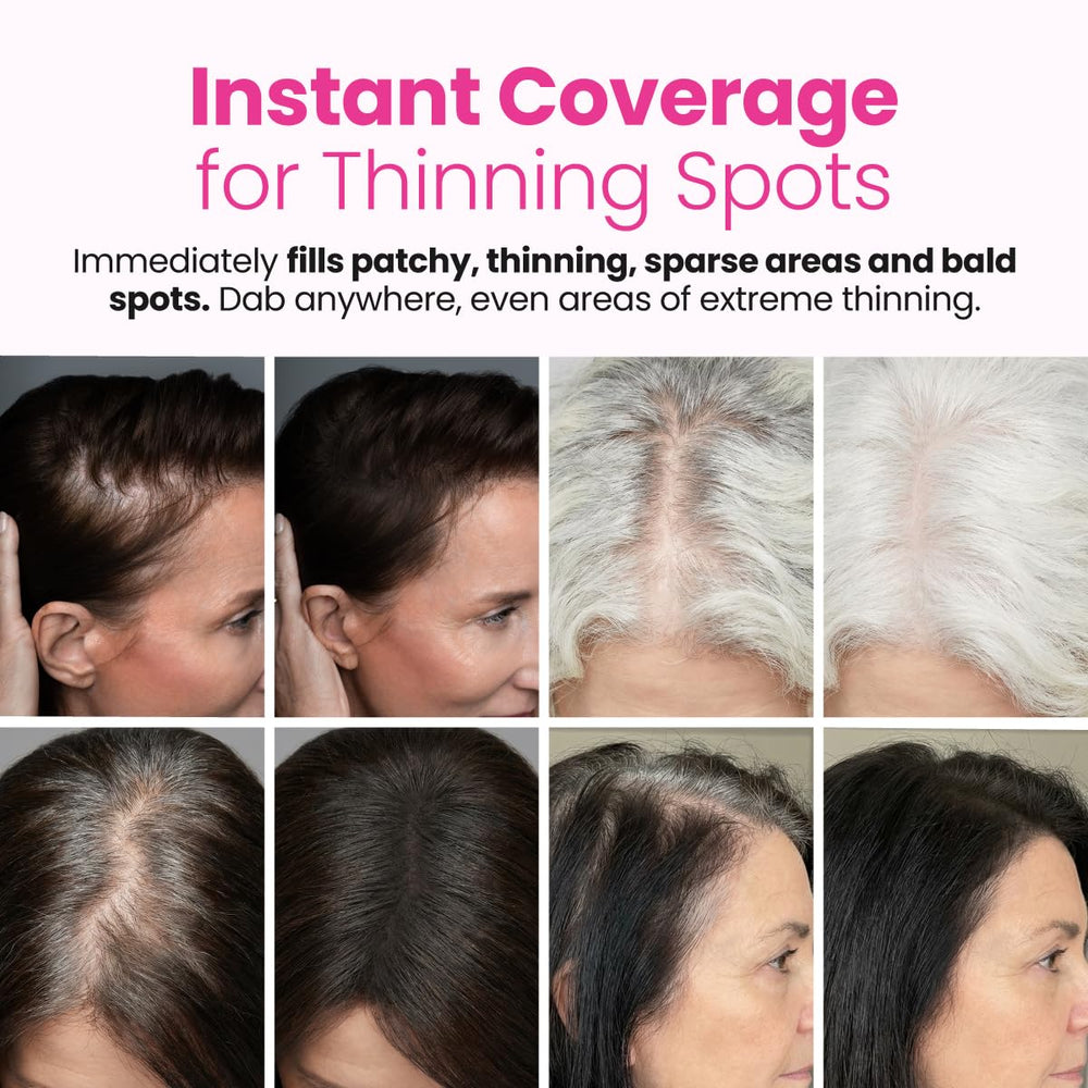Prime Prometics before and after on thinning area showing fuller-looking hair