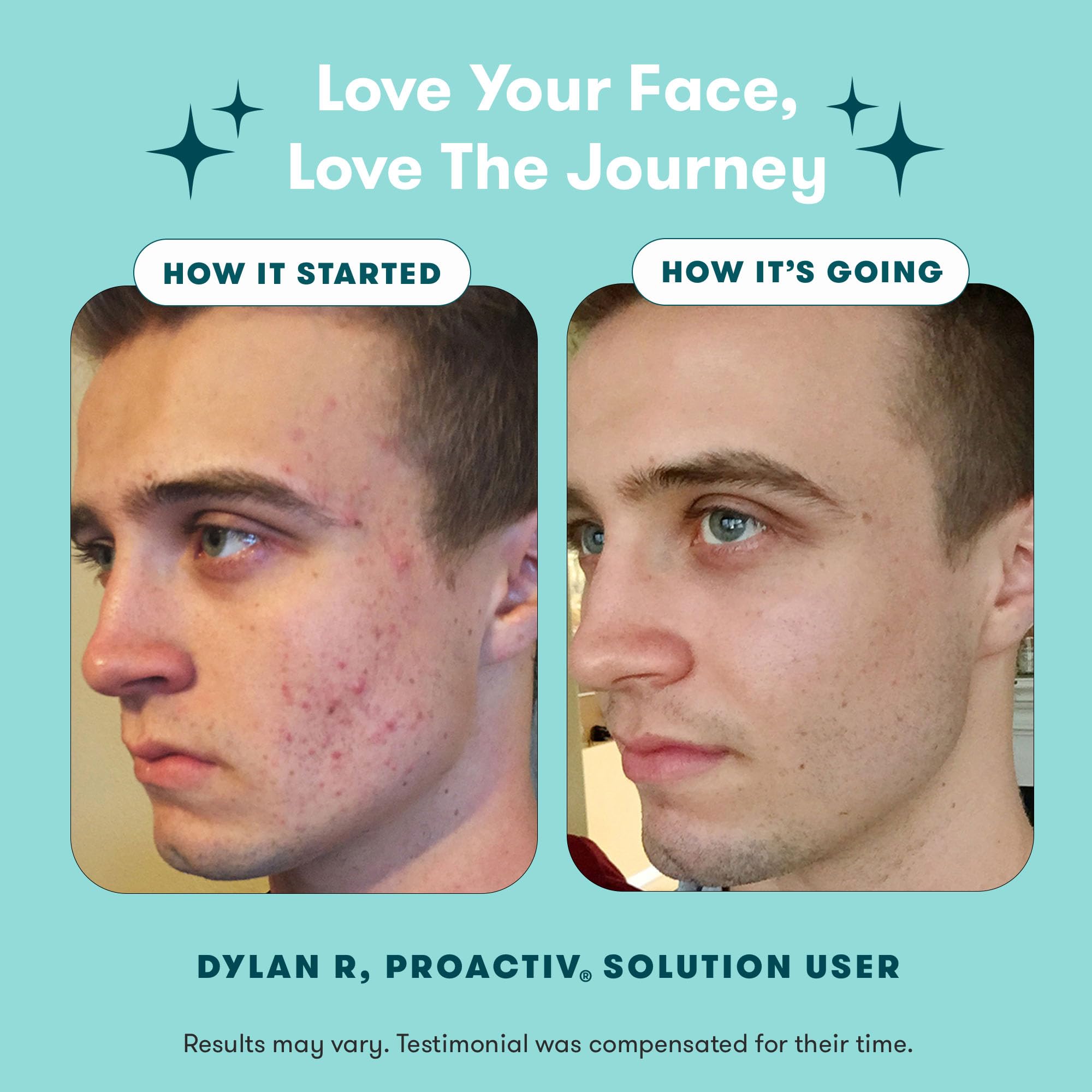 Proactiv pimple patches pack open for discreet overnight protection benefit