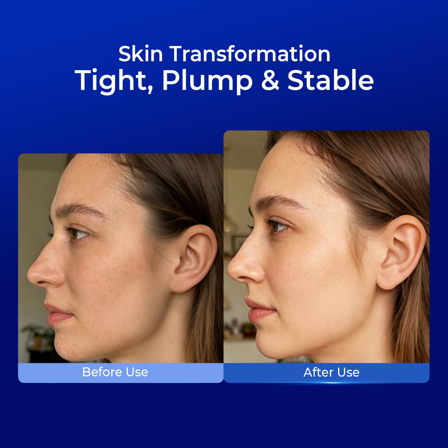 PROF.LING serum applied to skin after microneedling to soothe and hydrate