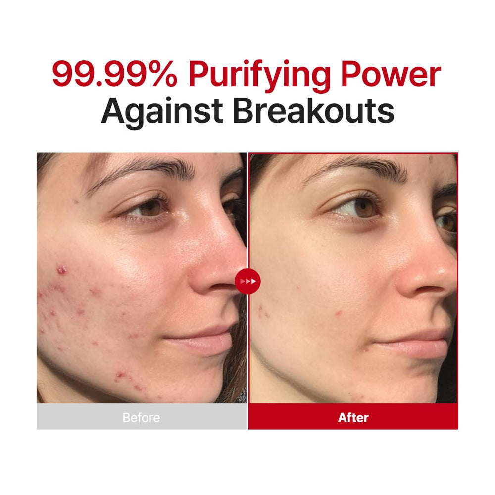 PURITO mist landing on skin showing lightweight texture and soothing benefit