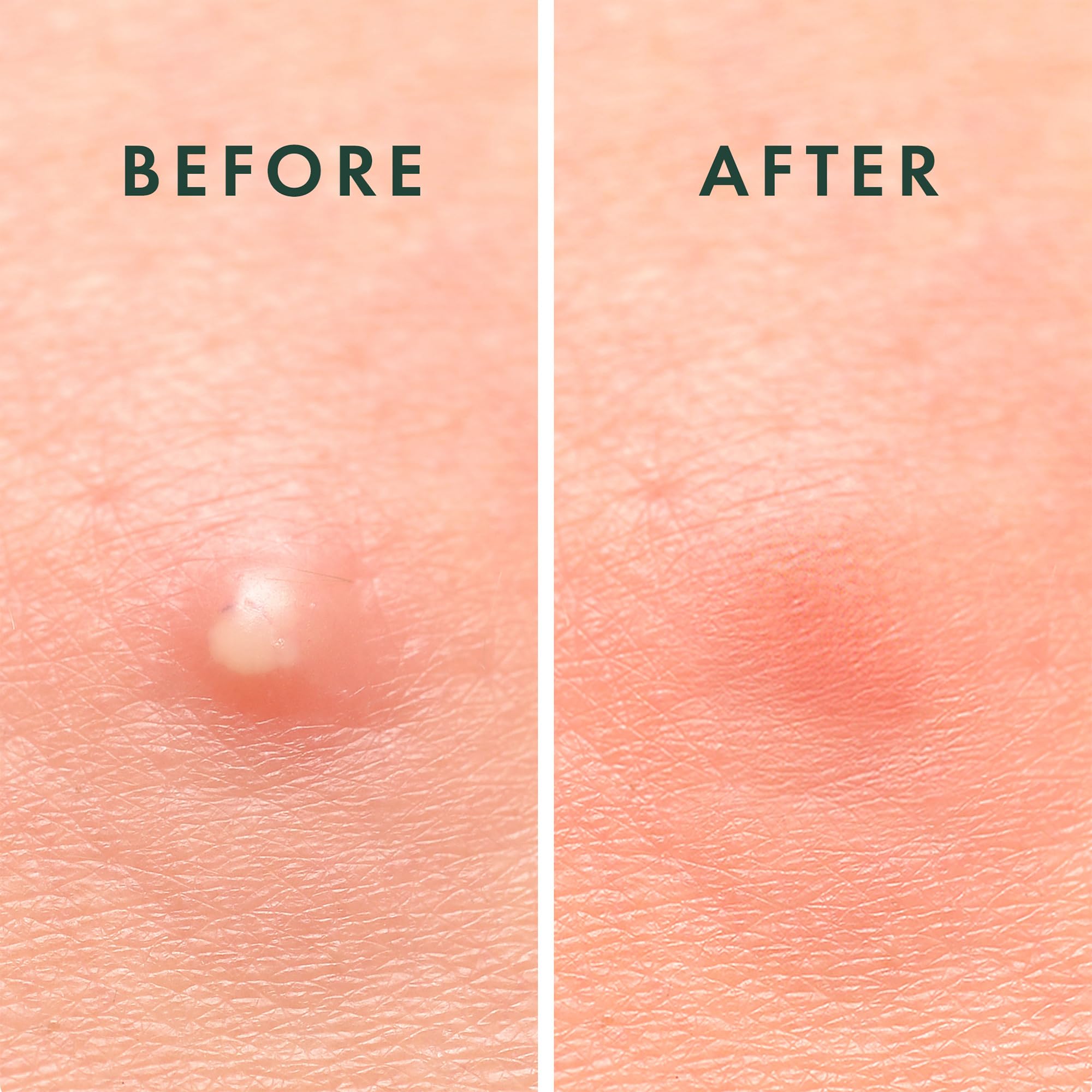 Rael patch on skin close-up demonstrating discreet coverage benefit