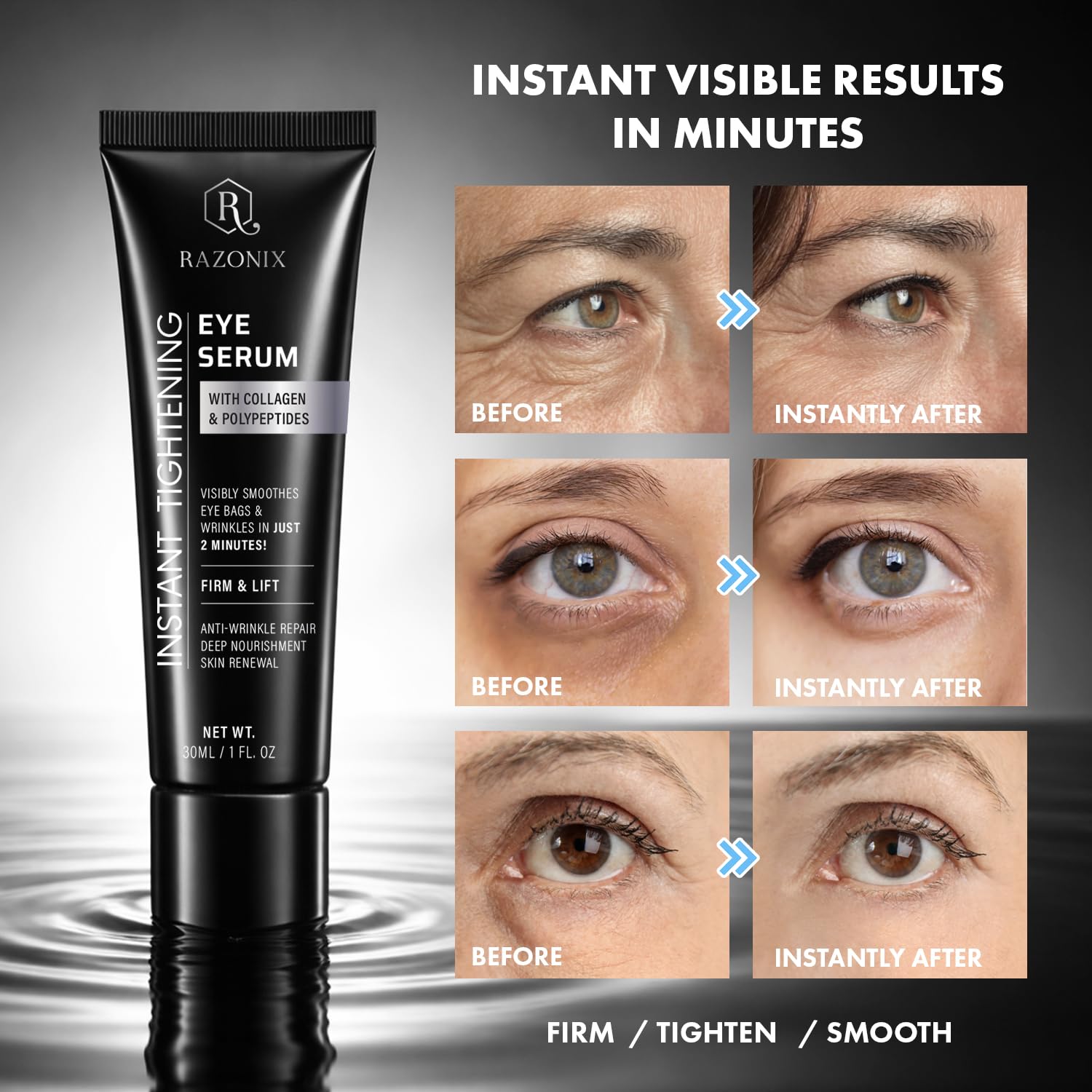 RAZONIX serum drop on fingertip emphasizing precise application