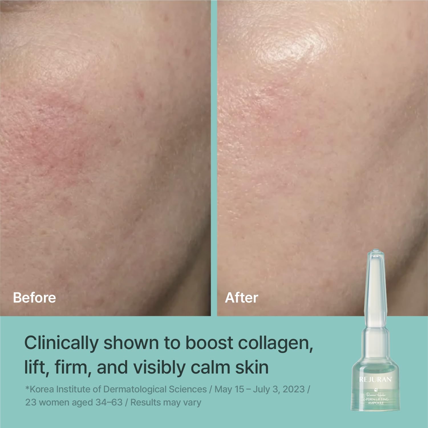 REJURAN ampoule application on face demonstrating soothing hydration benefits