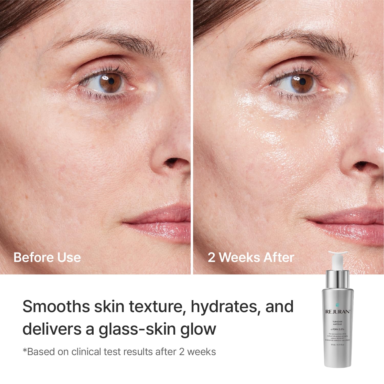 REJURAN ampoule on hand showing scale and precise dosing benefit
