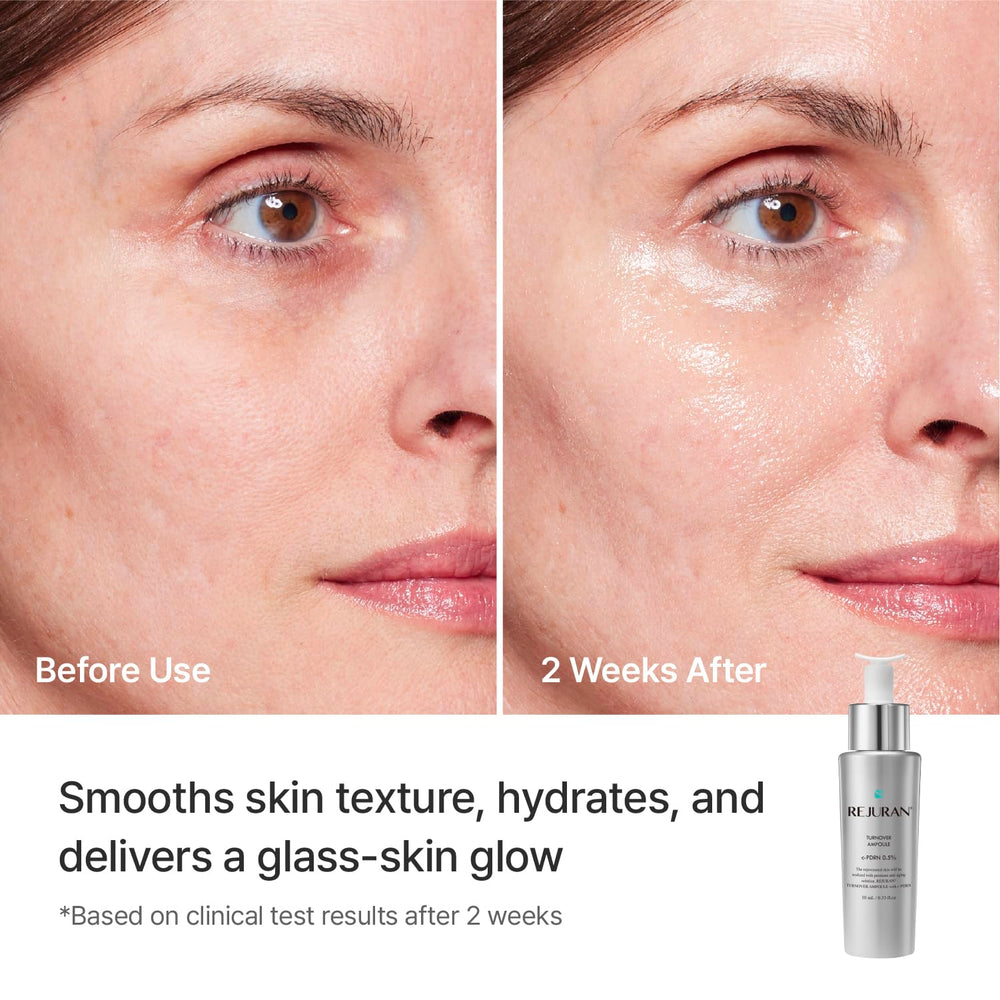 REJURAN ampoule on hand showing scale and precise dosing benefit