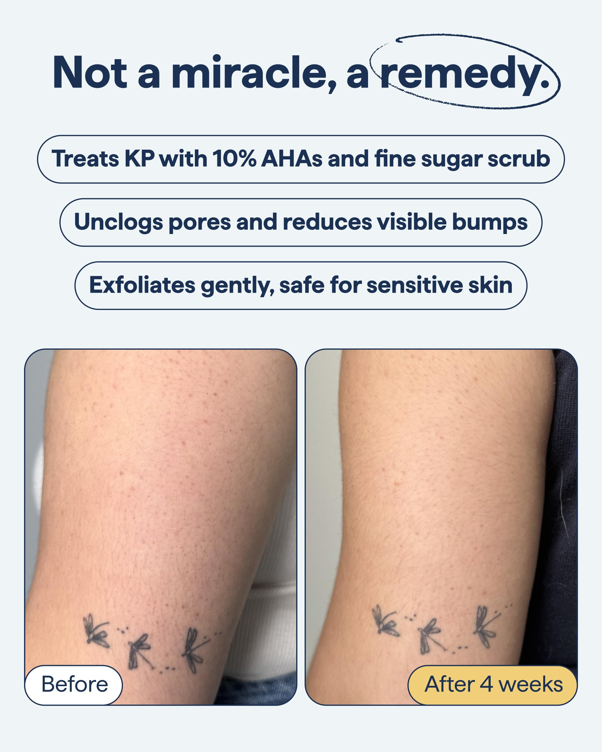 Remedy Science ingredient label highlighting glycolic and lactic acids for resurfacing