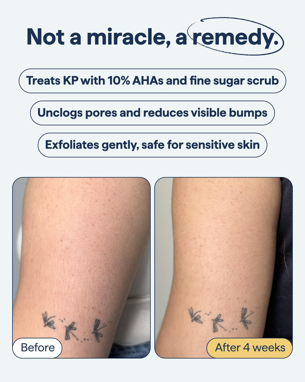 Remedy Science ingredient label highlighting glycolic and lactic acids for resurfacing