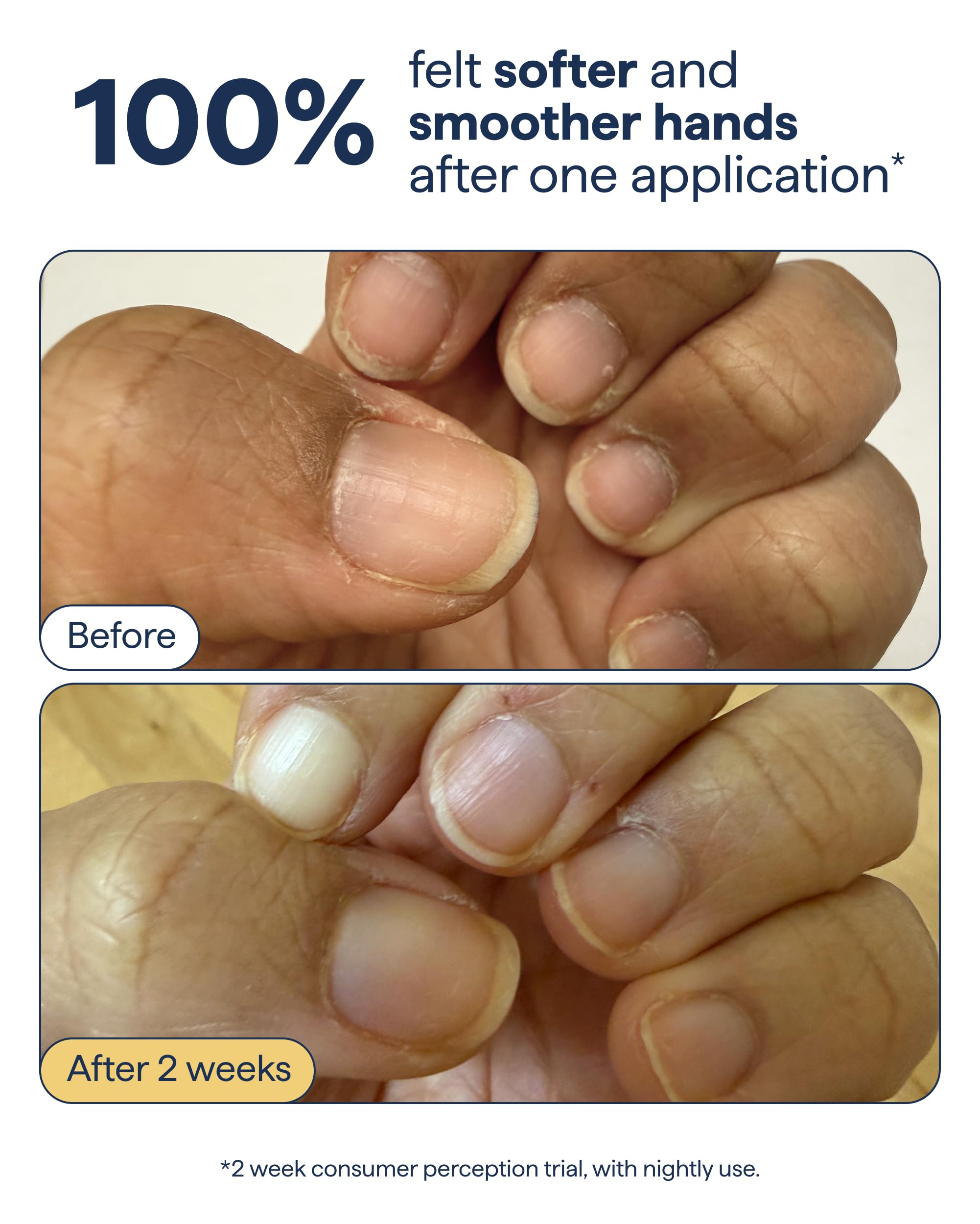 Remedy Science cream being dispensed on hand demonstrating quick application benefit