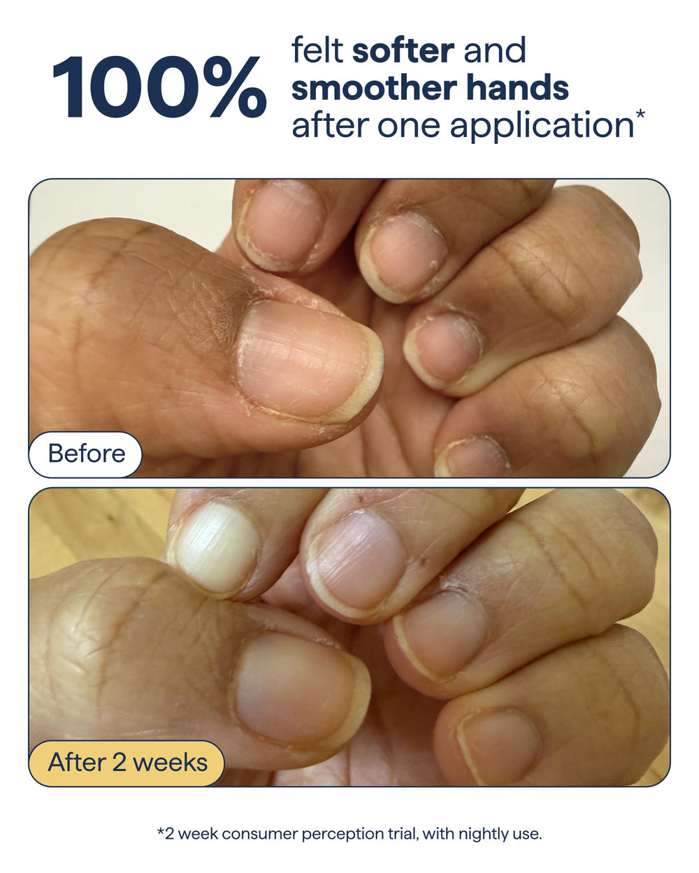 Remedy Science cream being dispensed on hand demonstrating quick application benefit