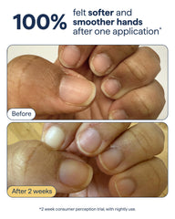 Remedy Science cream being dispensed on hand demonstrating quick application benefit