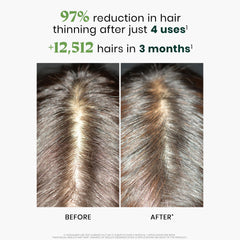 René Furterer serum texture drop illustrating lightweight formula for easy scalp absorption