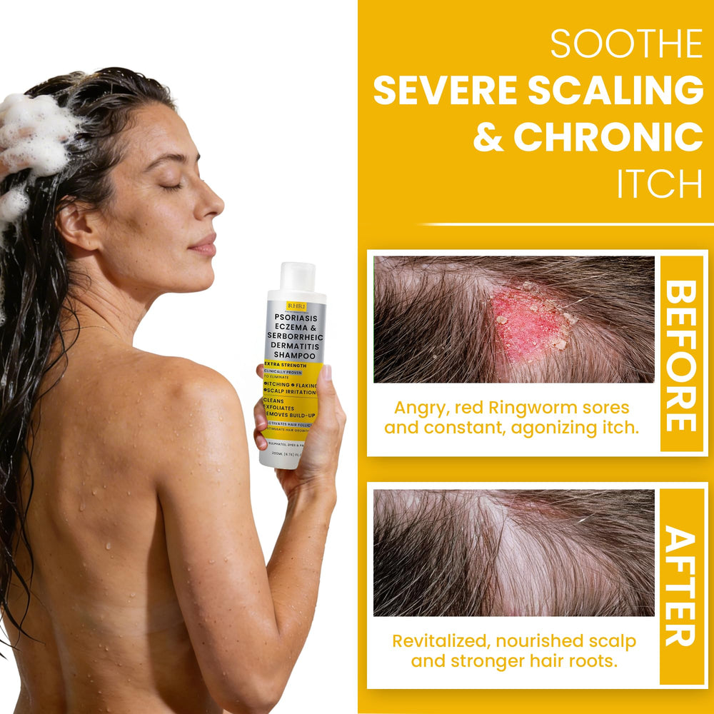 Rida Hair Research Institute bottle beside Manuka honey and tea tree for soothing benefits