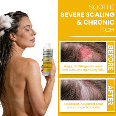 Rida Hair Research Institute bottle beside Manuka honey and tea tree for soothing benefits