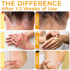 Rida Hair Research Institute being applied to scalp to reduce flaking and calm itch