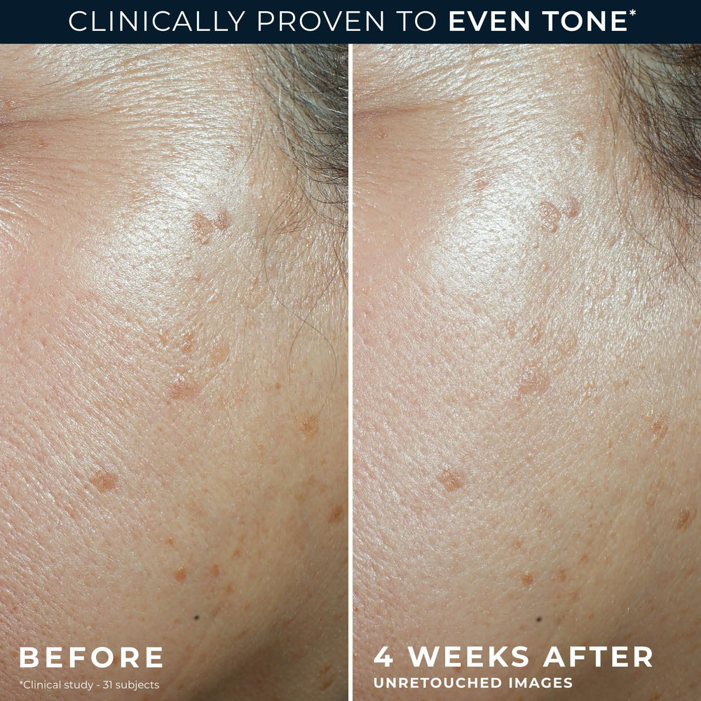 RoC applied to cheek to demonstrate hydration and smooth finish