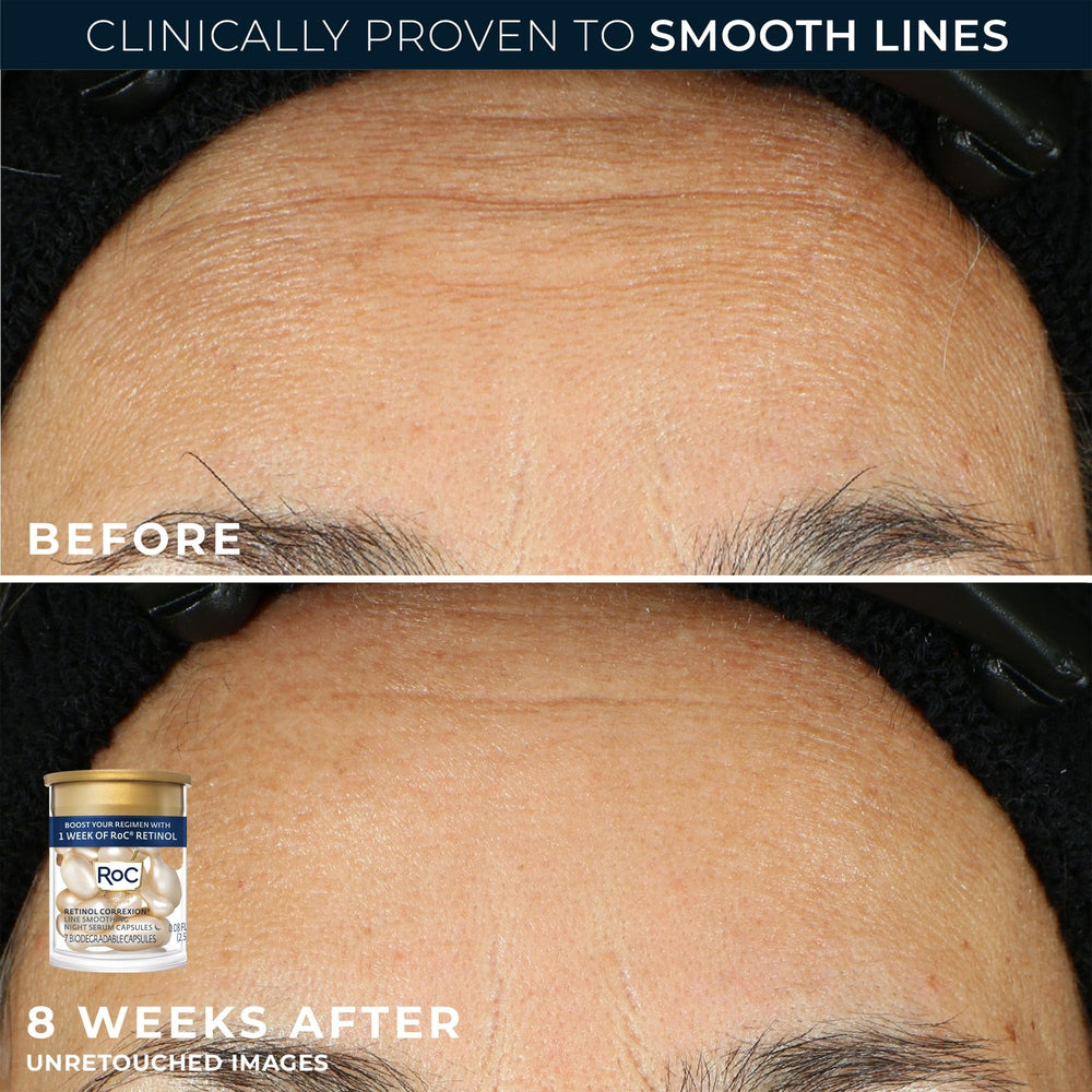 RoC single serum capsule in hand demonstrating measured overnight use