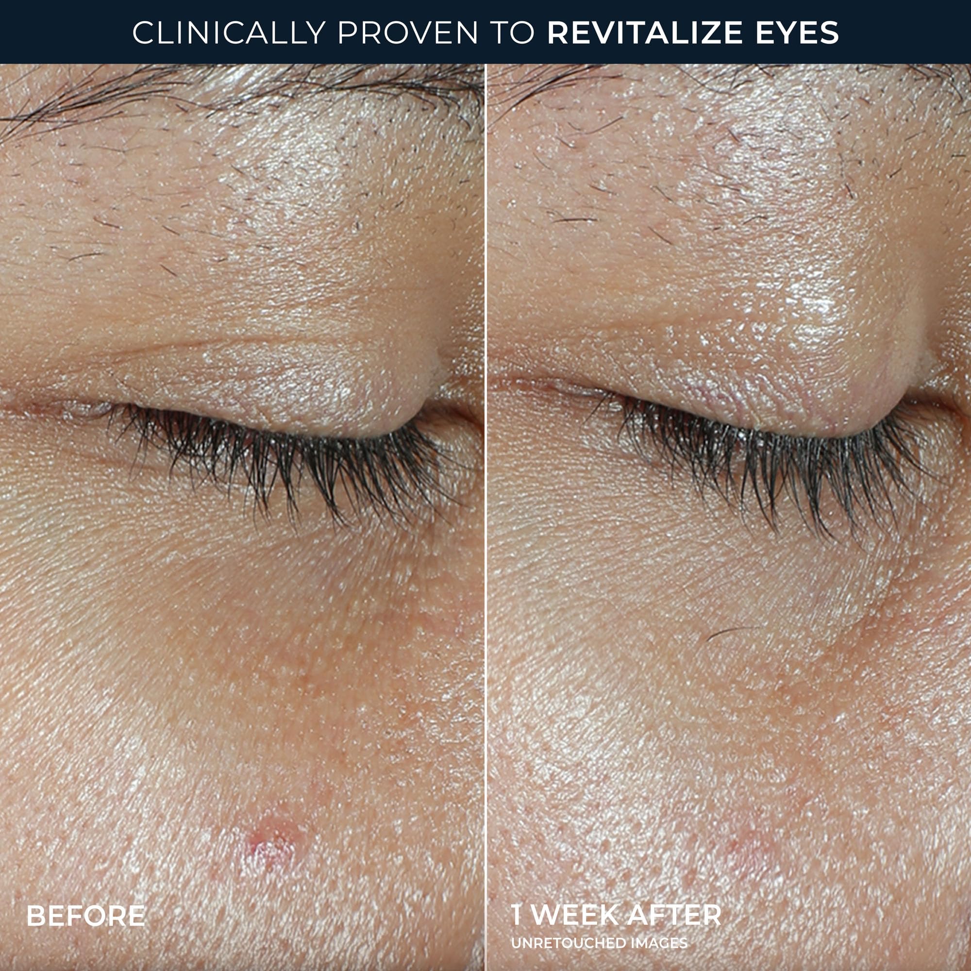 RoC applying balm under eye demonstrating depuffing and refreshed appearance